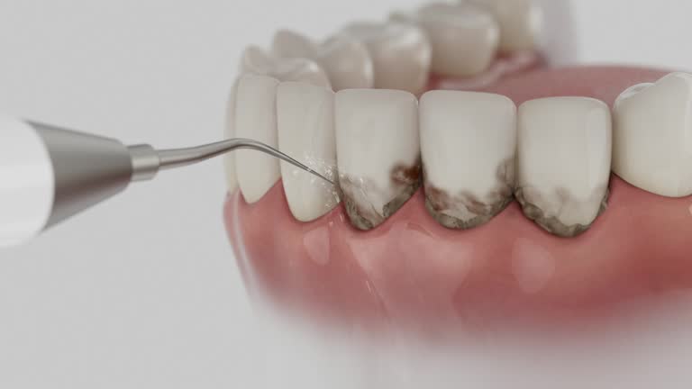 Trusted Root Canal Treatment service in Crystal Lakes, OH - Dentist Open Now